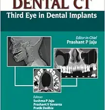 Dental CT: Third Eye in Dental Implants
