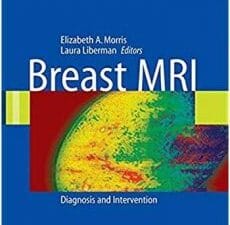 breast mri: diagnosis and intervention