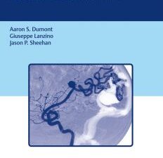 brain arteriovenous malformations and arteriovenous fistulas