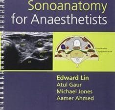 Sonoanatomy for Anaesthetists