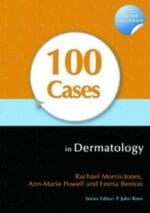 100 Cases in Dermatology 1st Edition