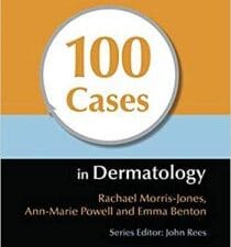 100 Cases in Dermatology