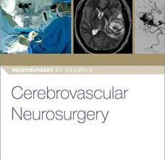 cerebrovascular neurosurgery (neurosurgery by example)