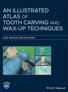 An Illustrated Atlas of Tooth Carving and Wax-Up Techniques 1st Edition