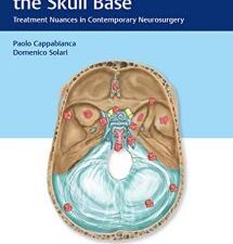 meningiomas of the skull base: treatment nuances in contemporary neurosurgery 1st edition