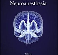 Essentials of Neuroanesthesia 1st Edition