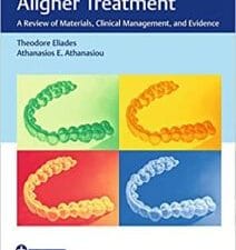 Orthodontic Aligner Treatment: A Review of Materials, Clinical Management, and Evidence 1st Edition