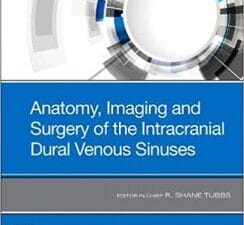 Anatomy, Imaging and Surgery of the Intracranial Dural Venous Sinuses 1st Edition