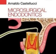 Microsurgical Endodontics