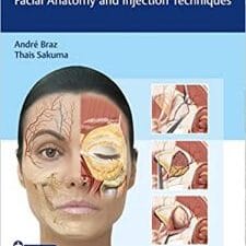 Dermal Fillers: Facial Anatomy and Injection Techniques 1st Edition