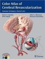 color atlas of cerebral revascularization: anatomy, techniques, clinical cases 1st edition