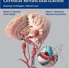 color atlas of cerebral revascularization: anatomy, techniques, clinical cases 1st edition