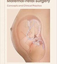 Anesthesia for Maternal-Fetal Surgery: Concepts and Clinical Practice