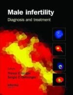 male infertility: diagnosis and treatment 1st edition