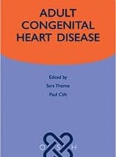 Adult Congenital Heart Disease (Oxford Specialist Handbooks in Cardiology) 1st Edition