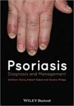Psoriasis: Diagnosis and Management 1st Edition