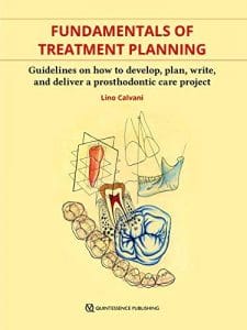 Fundamentals of Treatment Planning: Guidelines on How to Develop, Plan, Write, and Deliver a Prosthodontic Care 1st Edition