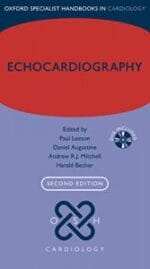 Echocardiography (Oxford Specialist Handbooks in Cardiology) 2nd Edition