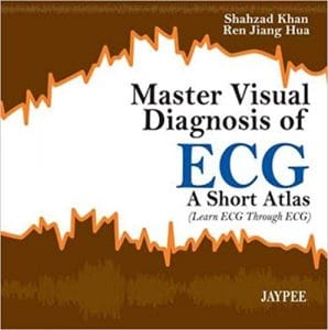 Master Visual Diagnosis of Ecg: A Short Atlas (Learn ECG Through Ecg) 1st Edition