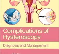 complications of hysteroscopy: diagnosis and management 1st edition