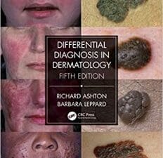 Differential Diagnosis in Dermatology 5th Edition