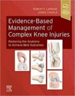 Evidence-Based Management of Complex Knee Injuries: Restoring the Anatomy to Achieve Best Outcomes 1st Edition