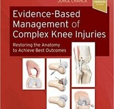 Evidence-Based Management of Complex Knee Injuries: Restoring the Anatomy to Achieve Best Outcomes 1st Edition