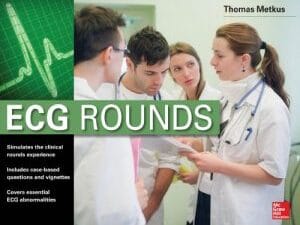 ECG Rounds 1st Edition