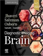 diagnostic imaging: brain 4th edition