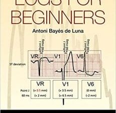 ECGs for Beginners 1st Edition