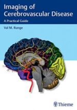 imaging of cerebrovascular disease: a practical guide 1st edition