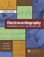 Electrocardiography in Emergency, Acute, and Critical Care