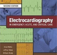 Electrocardiography in Emergency, Acute, and Critical Care