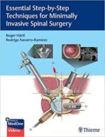 essential step by step techniques for minimally invasive spinal surgery 1st edition