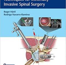 essential step by step techniques for minimally invasive spinal surgery 1st edition