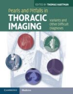 Pearls and Pitfalls in Thoracic Imaging: Variants and Other Difficult Diagnoses 1st Edition
