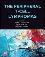the peripheral t cell lymphomas 1st edition