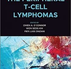 the peripheral t cell lymphomas 1st edition