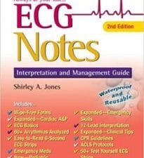 ECG Notes: Interpretation and Management Guide Second Edition