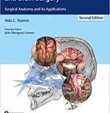 transnasal endoscopic skull base and brain surgery: surgical anatomy and its applications 2nd edition