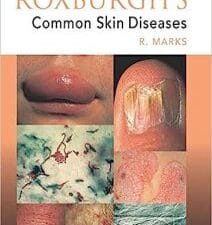 Roxburgh’s Common Skin Diseases 17th Edition