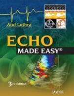 Echo Made Easy 3rd Edition