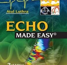 Echo Made Easy 3rd Edition