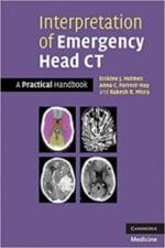 Interpretation of Emergency Head CT: A Practical Handbook 1st Edition