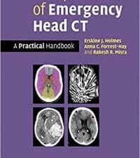 Interpretation of Emergency Head CT: A Practical Handbook 1st Edition