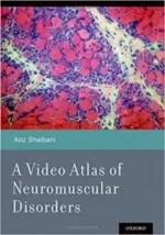a video atlas of neuromuscular disorders 1st edition