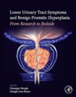 lower urinary tract symptoms and benign prostatic hyperplasia: from research to bedside 1st edition