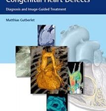 Diagnostic Imaging of Congenital Heart Defects: Diagnosis and Image-Guided Treatment 1st Edition