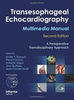 Transesophageal Echocardiography Multimedia Manual: A Perioperative Transdisciplinary Approach, 2nd edition