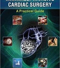 Minimally Invasive Cardiac Surgery: A Practical Guide 1st Edition